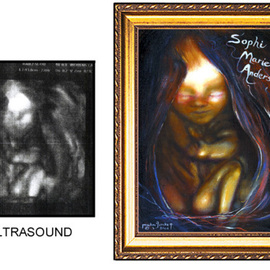Michael Pickett: 'Ultrasound', 2006 Acrylic Painting, Life. Artist Description:  This is a painting of an Ultrasound, Commissioned. ...