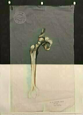 Lou Posner, 'Hip Joint', 2021, original Pastel, 11 x 15  x 0.1 inches. Artwork description: 1911 A human hip joint.  Pastel pencil on tracing paper mounted on black paper and Twin Rocker cream paper.  For my orthopedist.  4- 9- 21.  ...