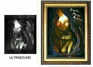 Michael Pickett, 'Ultrasound', 2006, original Painting Acrylic, 9 x 11  x 1 inches. Artwork description: 5079  This is a painting of an Ultrasound, Commissioned. ...